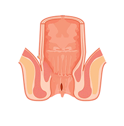 Laparoscopic surgeon in Mumbai