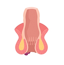 Laparoscopic surgeon in Mumbaia