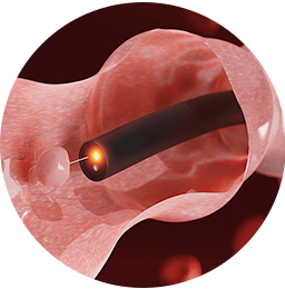 Laparoscopic surgeon in Mumbai