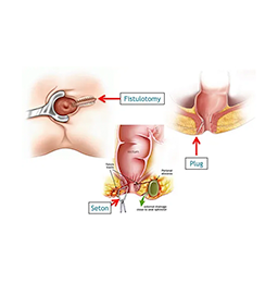 Laparoscopic surgeon in Mumbai